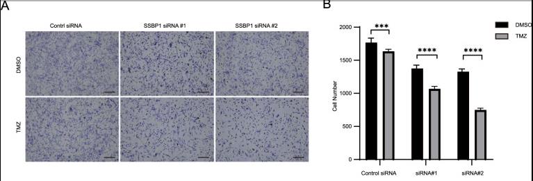 Downregulation of SSBP1 increased TMZ sensitivity.jpg